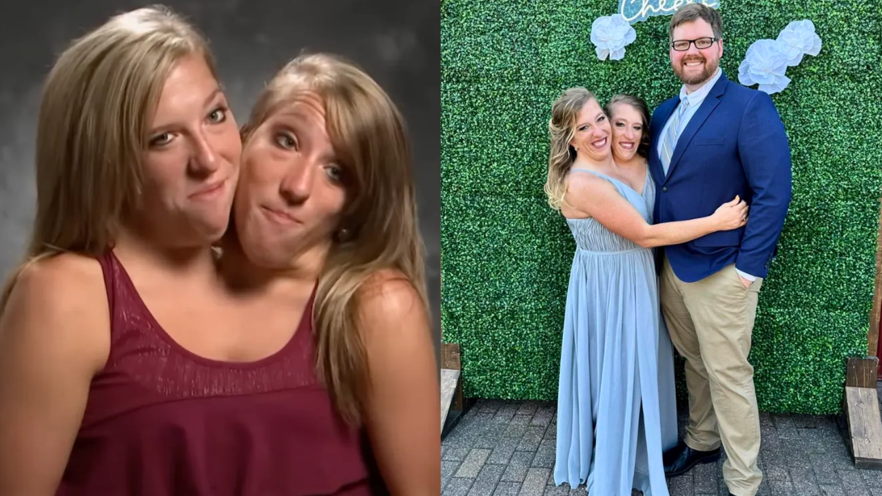 ¿Cómo es la vida íntima de las siamesas Abby y Brittany Hensel? Una de ellas se casó recientemente