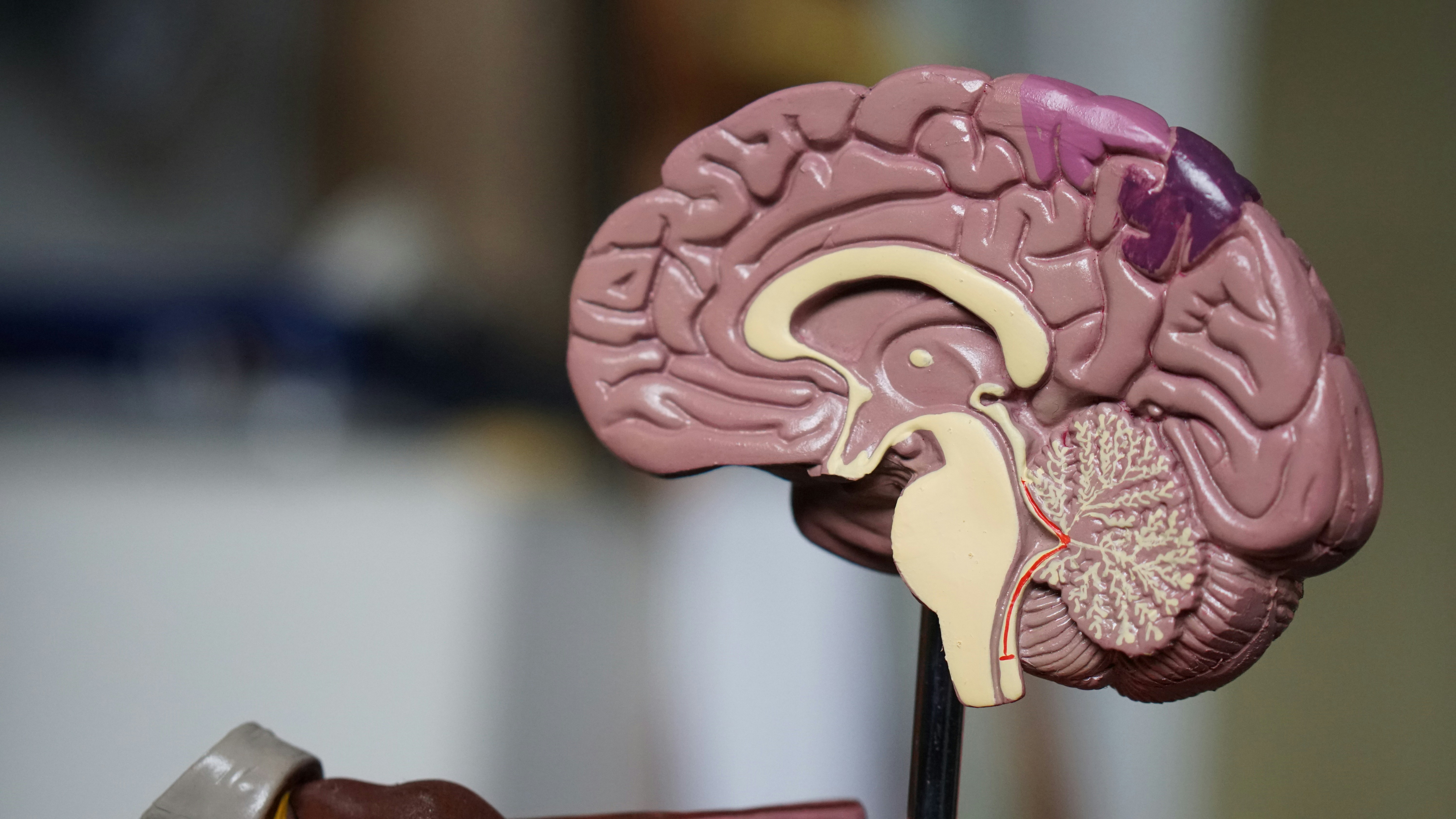 ¡Mucho cuidado! Estos cuatro cambios en su vida podrían ser síntomas tempranos de Alzheimer 