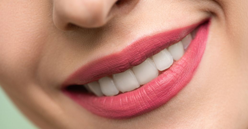 ¿De qué color deben ser los dientes cuando están sanos?