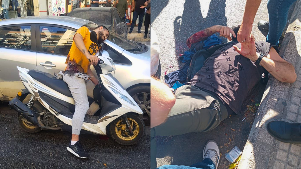 Surreal: ataque con explosiones de buscapersonas causaron más de 2 mil heridos en Líbano y Siria