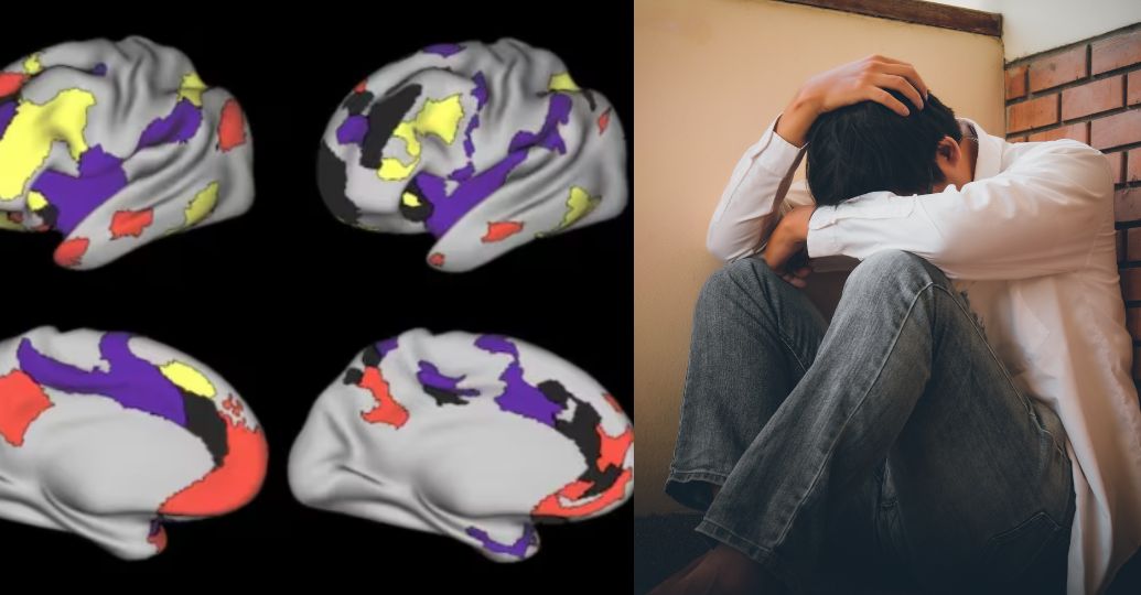 Científicos descubren efectos de la depresión en importante red cerebral