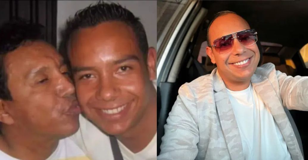 Miguel Ángel Díaz, hijo de Diomedes Díaz, perdió una pierna por esta enfermedad