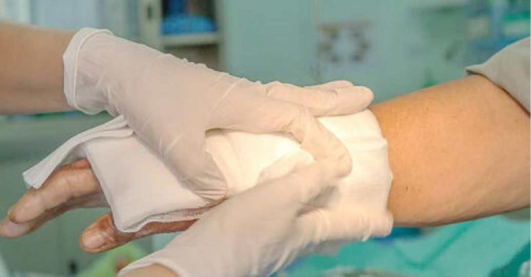 Estas son las sanciones para los padres de menores que resulten quedamos con pólvora