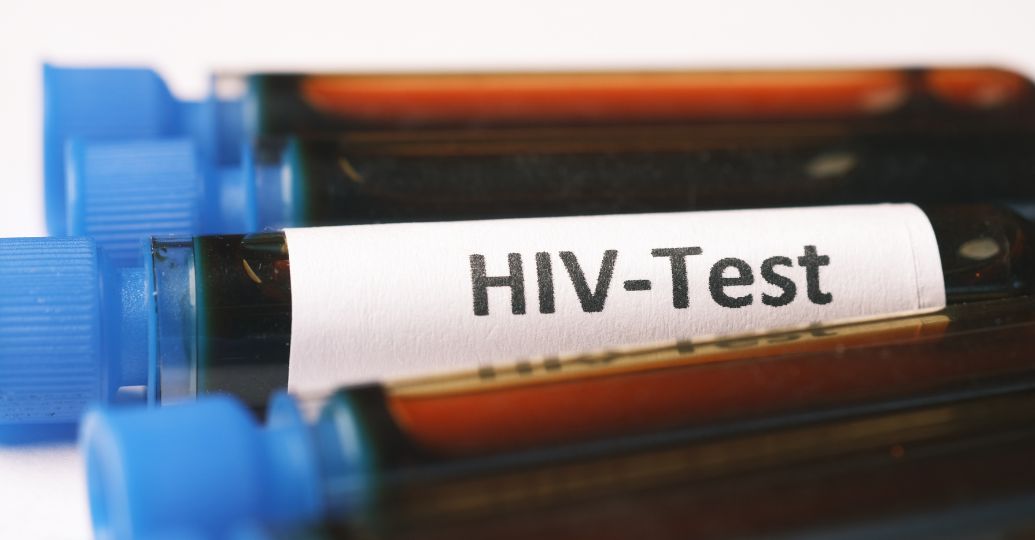 ¿Hay una epidemia de VIH en Colombia? esto dicen las cifras