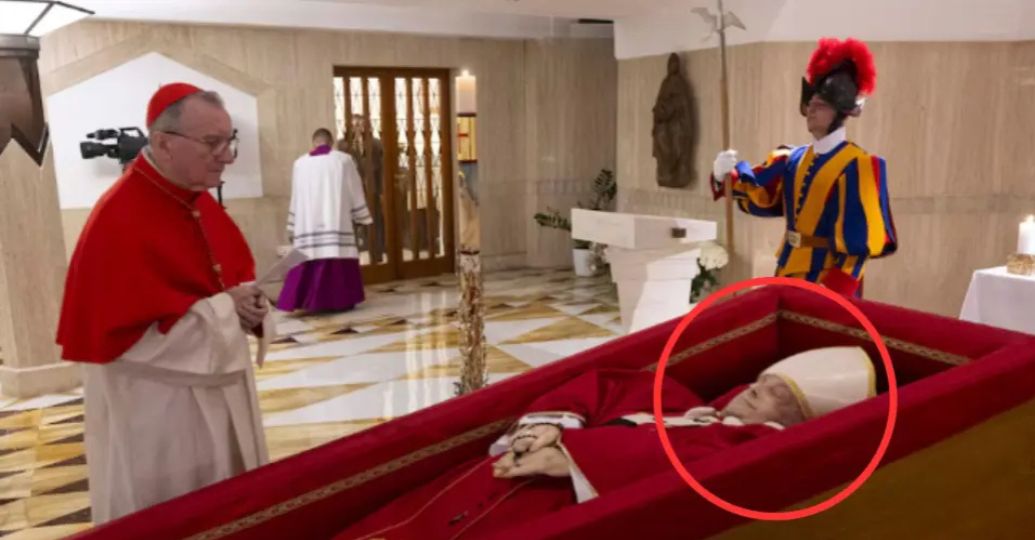 Imagen del papa Francisco genera preguntas tras revelar hematoma en su rostro