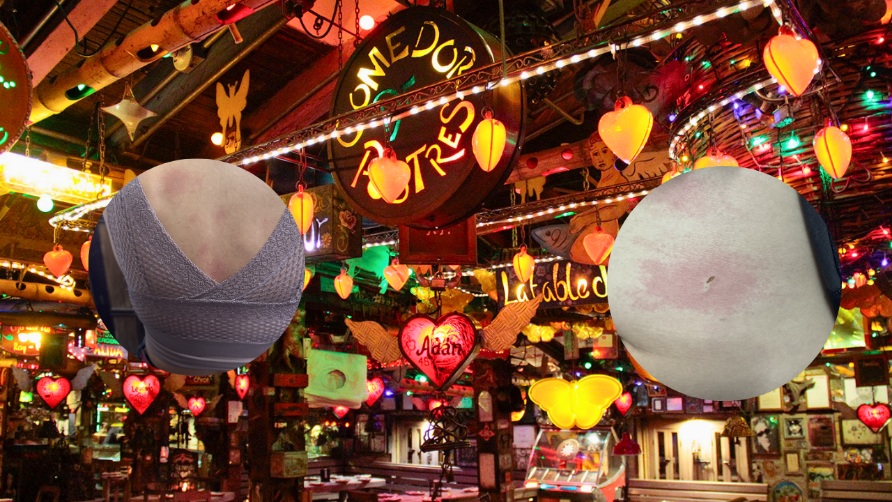 Grave denuncia en Andrés Carne de Res: falla en máquina de humo dejó nueve afectados