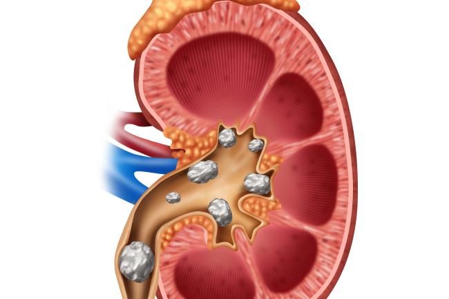 ¿Qué le pasó a Juancho de la Espriella? Hay preocupación por su salud tras ser operado de urgencia
