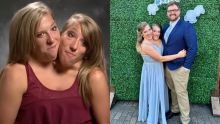 ¿Cómo es la vida íntima de las siamesas Abby y Brittany Hensel? Una de ellas se casó recientemente
