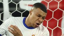 Imágenes sensibles | Así le quedó la nariz a Mbappé después de un golpe: casi lo manda al quirófano